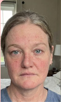 Day 1 – Niamh, 48