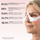 LED Under Eye Glasses - Under Eye Light Therapy for Dark Circles & Puffiness
