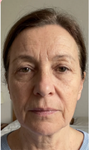 Day 1 – Agnes, 64
